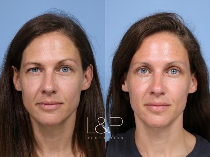 Dr. Lieberman and Dr. Parikh are up for challenging surgical cases and