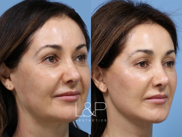 Practice Manager gets Signature Facelift
