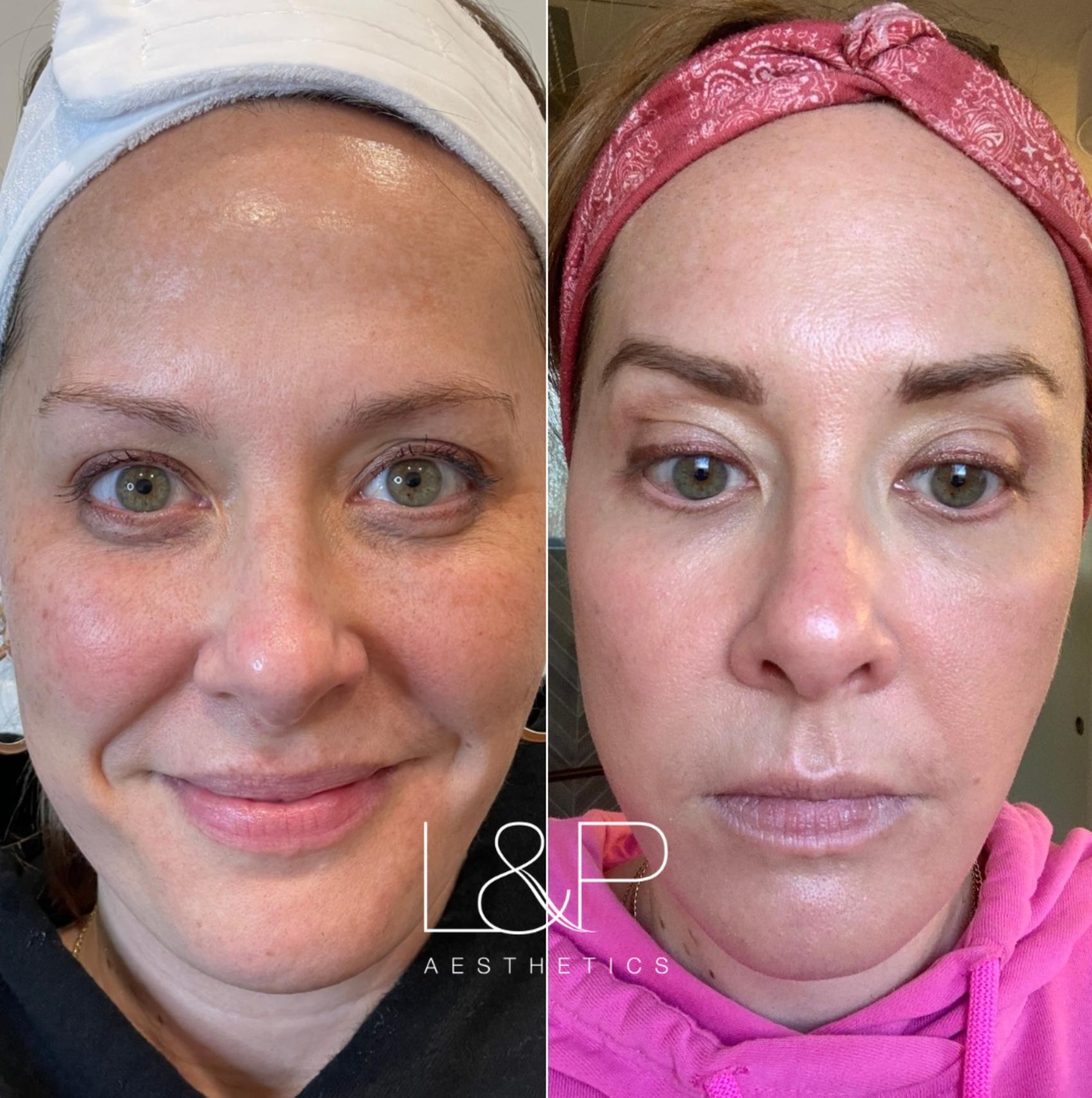 The Sophie Rain BBL Reveal: Jaw-Dropping Results